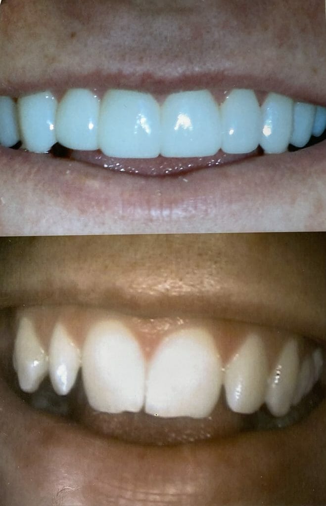 dental image medium