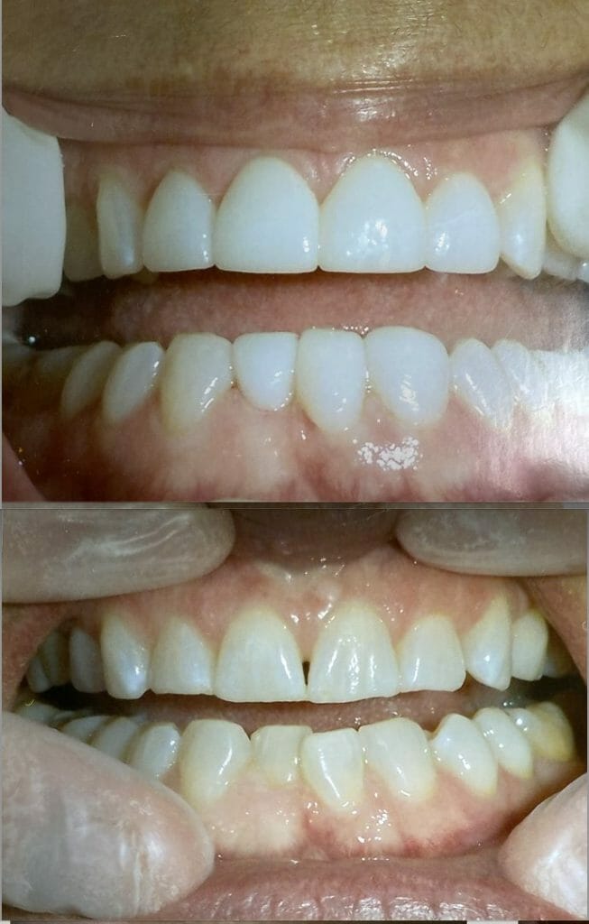 dental image close up
